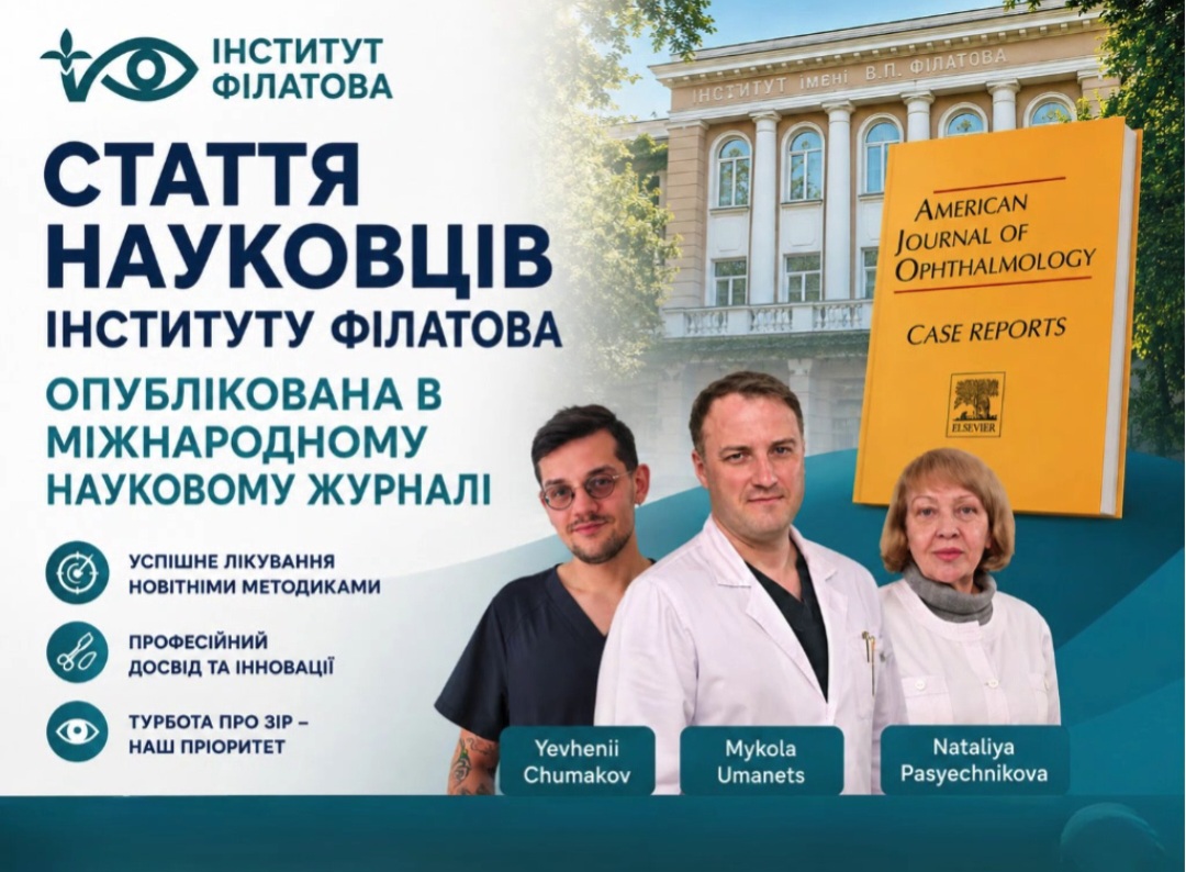 Стаття науковців інституту Філатова опублікована в міжнародному науковому журналі