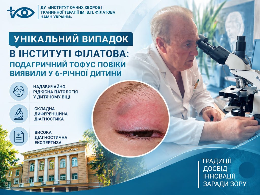 Унікальний випадок в Інституті Філатова: подагричний тофус повіки виявили у 6-річної дитини